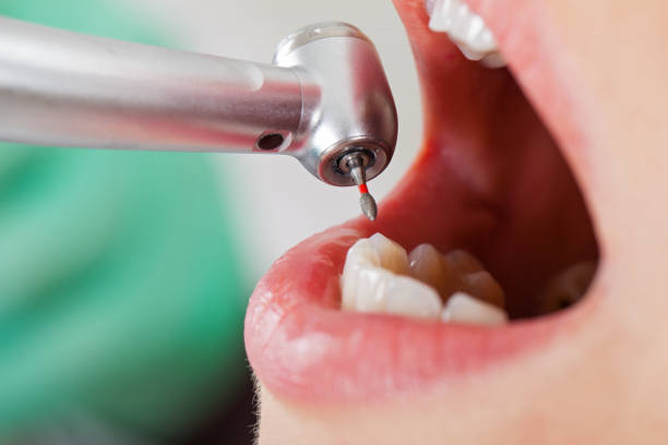 Best Pediatric Emergency Dentist in Tustin, CA